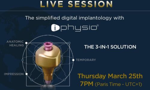 The simplified digital implantology with iPhysio