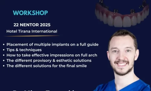 Digital Implantology In Full Arch Treatments – Workshop