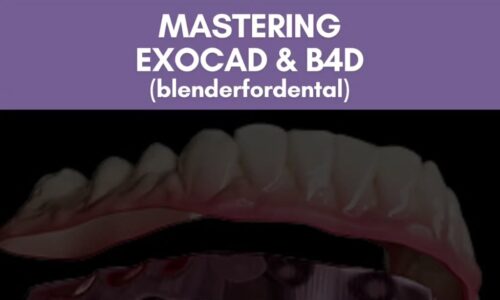 Mastering Exocad And B4d (Blenderfordental)