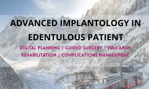 Advanced Implantology in the Edentulous Patient