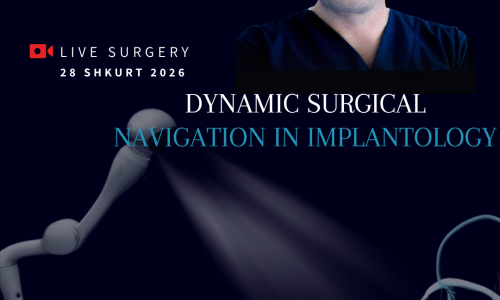 Dynamic Navigation in Implant Surgery