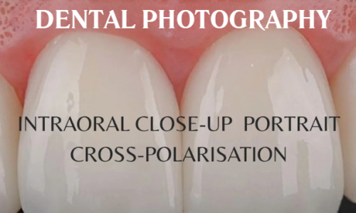 The Game Changers – Redefining Everyday Prosthodontics