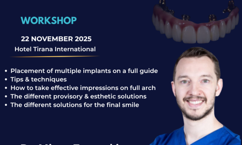 Digital Implantology In Full Arch Treatments – Workshop